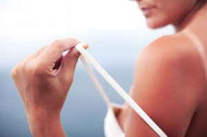 When Sunburn Sizzles, Remember the Aloe Vera Cream